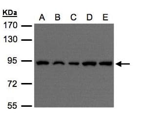 Polyclonal Rabbit anti-Human VPS35 Antibody (aa733-796, IHC, WB)