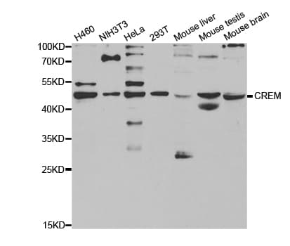 IHC-plus™ Polyclonal Rabbit anti-Human CREM / ICER Antibody (IHC, WB)