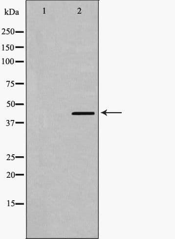 Polyclonal Rabbit anti-Human SMAD7 Antibody (WB)
