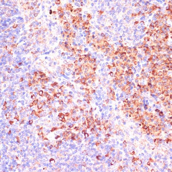 Polyclonal Rabbit anti-Human MZB1 Antibody (IHC)