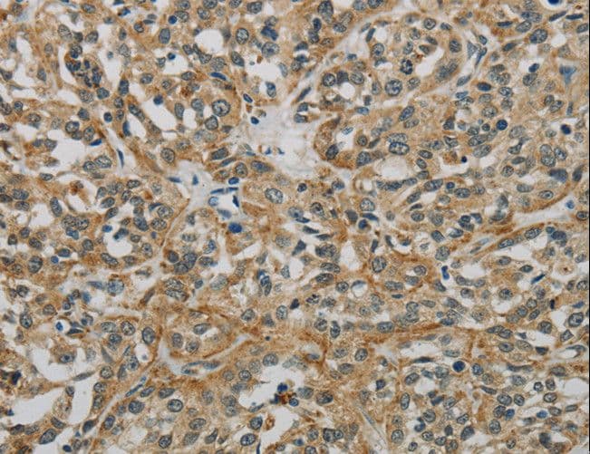 E2F6 Antibody