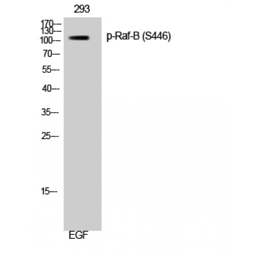 Polyclonal Rabbit anti-Human BRAF / B-Raf Antibody (380-460 aa, IHC, WB)