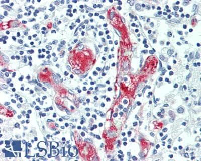 IHC-plus™ APOL1 / Apolipoprotein L Antibody