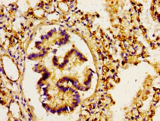 ARHGAP1 / CDC42GAP Antibody