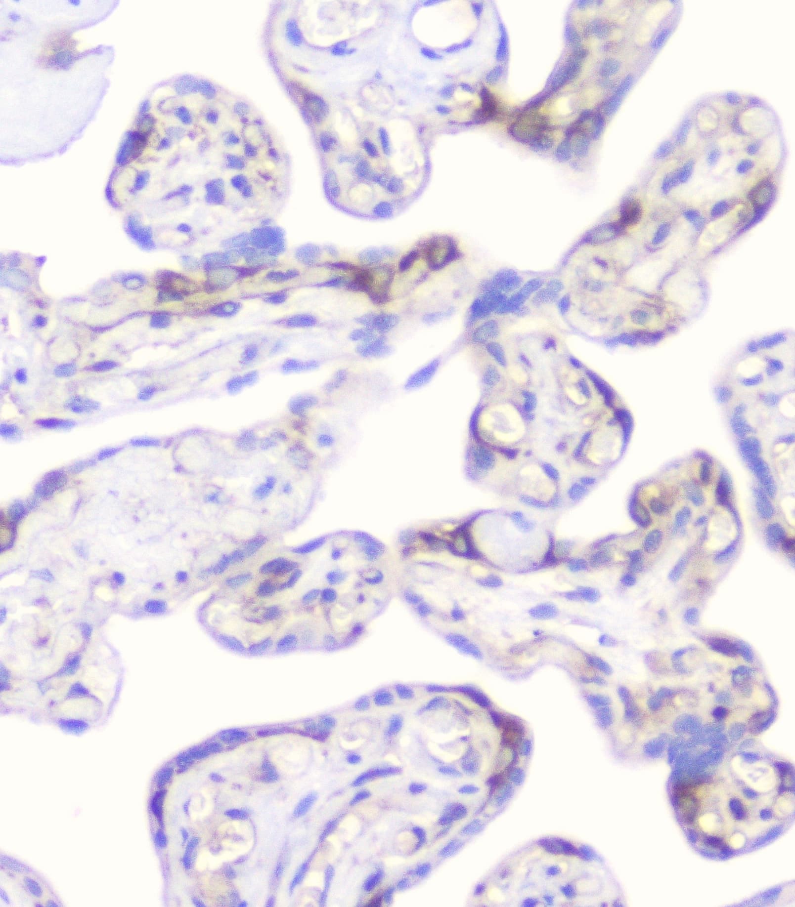 CD2AP Antibody
