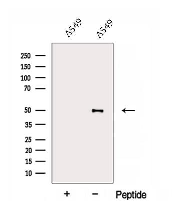 ESRRB / ERR Beta Antibody