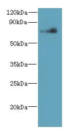 NEK11 Antibody