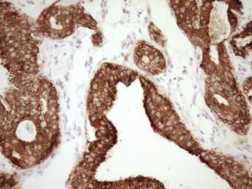 CALCA Antibody (clone 2D10)