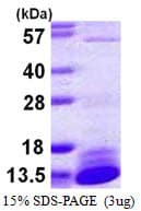 Human DYNLL2 Protein (Recombinant His)