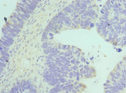 BAF53 / ACTL6A Antibody (aa1-280)