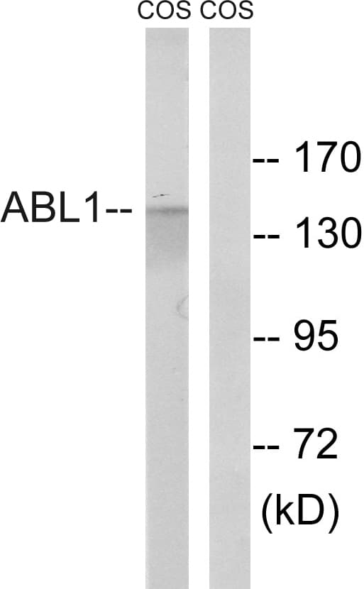 ABL1 / c-ABL Antibody (aa701-750)