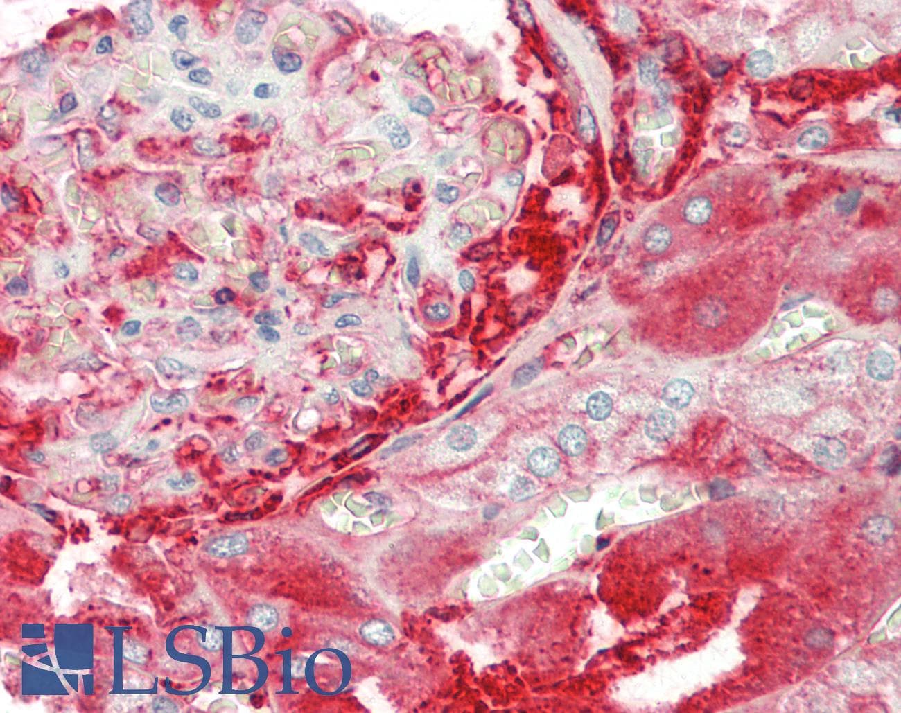 IHC-plus™ Polyclonal Rabbit anti-Human TF / Transferrin Antibody (IHC, WB)