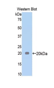 A2M / Alpha-2-Macroglobulin Antibody (aa574-734)