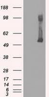 Monoclonal Mouse anti-Human GCK / Glucokinase Antibody (clone OTI3E3, IHC, IF, WB)