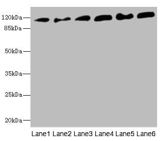 PCDH1 / PCD1 Antibody