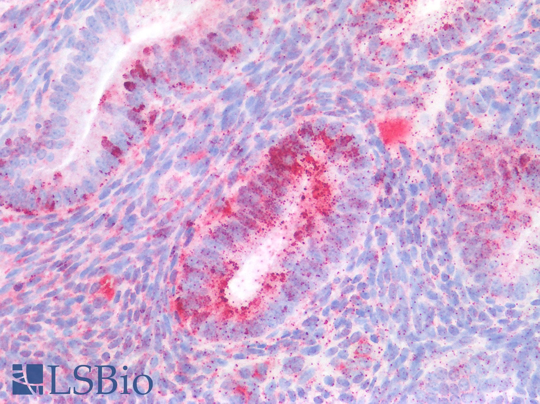 PathPlus™ EBI3 / IL-27B Antibody