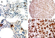 NALP1 / NLRP1 Antibody (aa161-180)