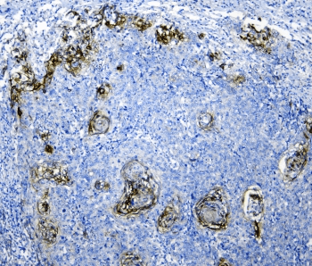 SLC34A2 / NaPi-2b Antibody