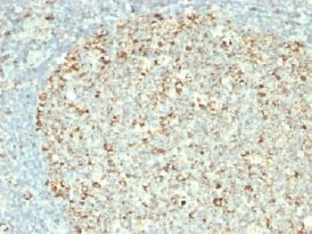 HSPD1 / HSP60 Antibody (clone GROEL/730)