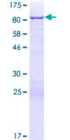 Human EEPD1 Protein (Recombinant GST)