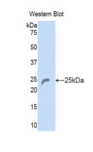 COL6A1 / Collagen VI Alpha 1 Antibody (aa816-1002)