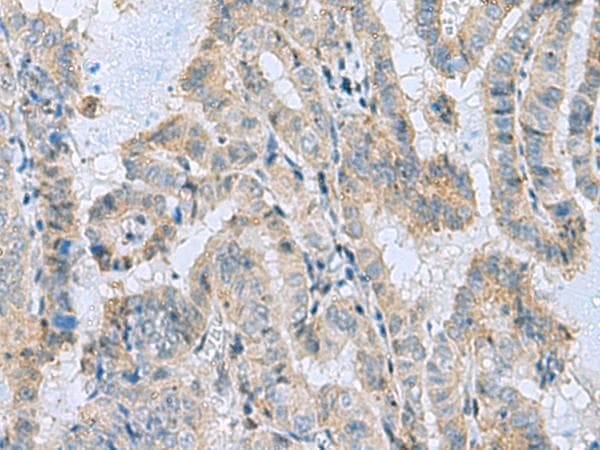 Polyclonal Rabbit anti-Human MGME1 / C20orf72 Antibody (IHC)