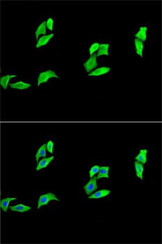 MB / Myoglobin Antibody