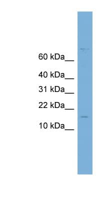 UBCH10 / UBE2C Antibody (aa71-120)