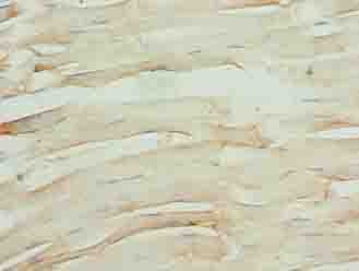 Polyclonal Rabbit anti-Human OSBPL6 Antibody (IHC)