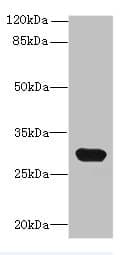 C1QTNF6 / CTRP6 Antibody