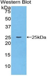 CTSK / Cathepsin K Antibody (aa116-329, Biotin)