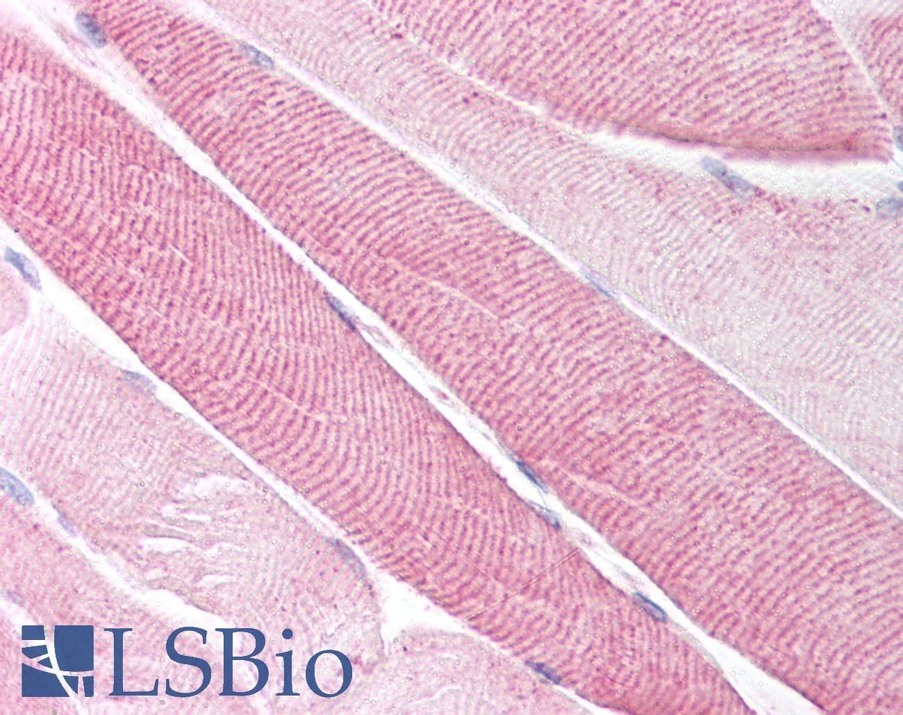 IHC-plus™ Polyclonal Rabbit anti-Human TACR2 / NK2R Antibody (Extracellular Domain, IHC)