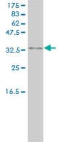 IHC-plus™ Monoclonal Mouse anti-Human PRKRA / PACT Antibody (clone 1B9-1A7, IHC, WB)