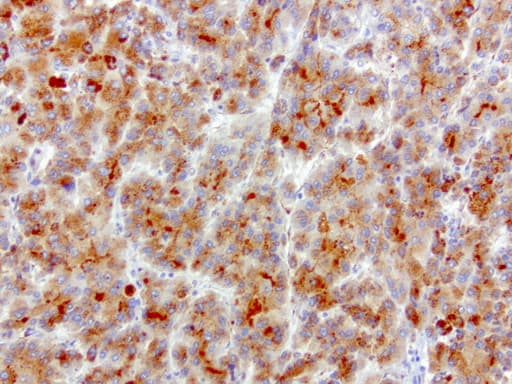 Monoclonal Mouse anti-Human SQSTM1 Antibody (clone UMAB12, Carrier-free, IHC, IF, WB)