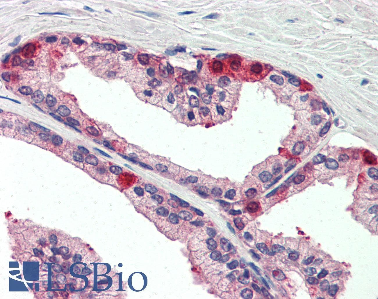 IHC-plus™ TAOK3 / JIK Antibody (aa396-411)