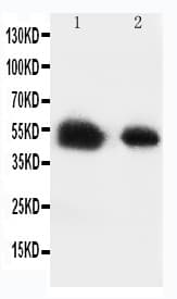 SLC2A8 / GLUT8 Antibody (aa461-477)