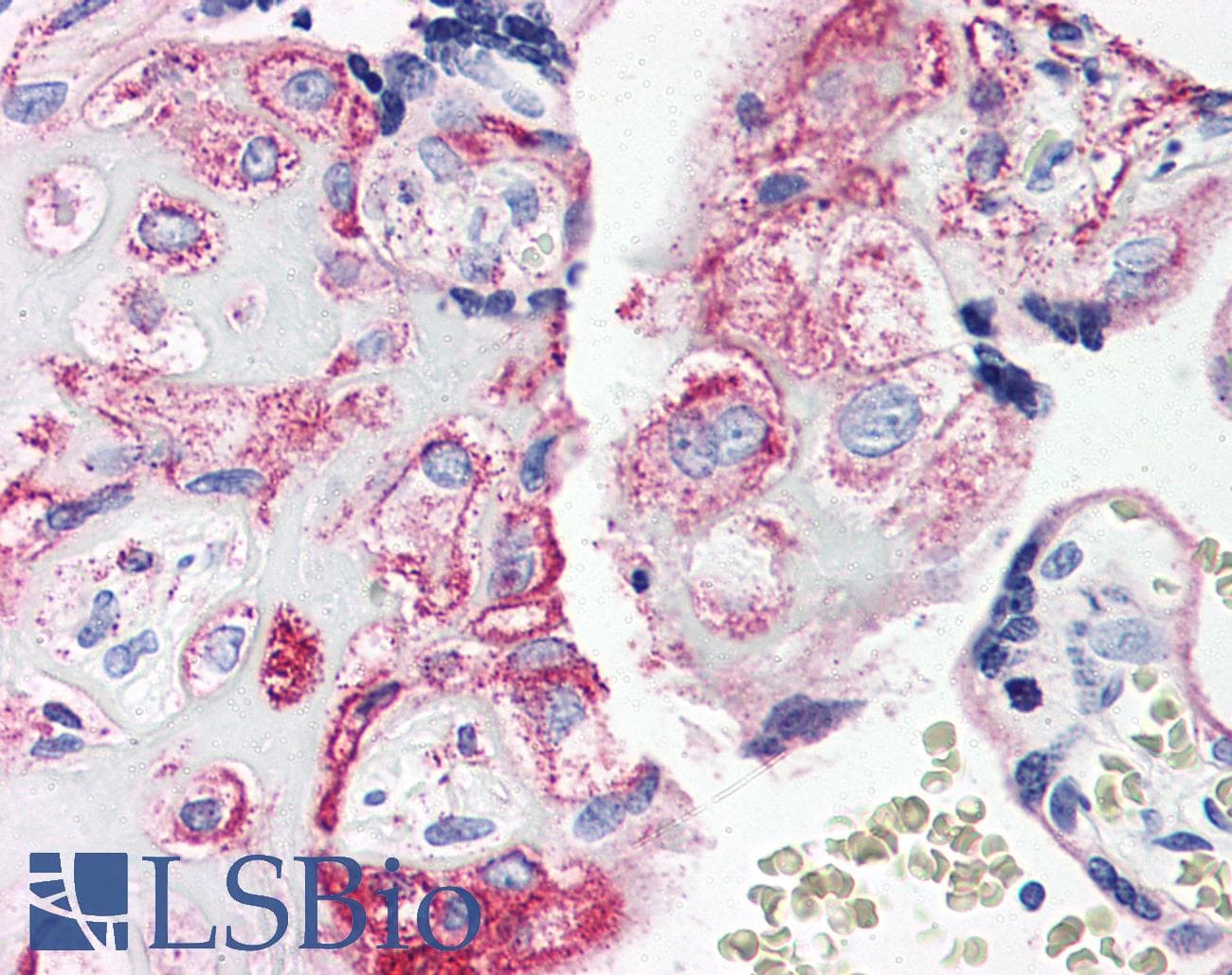 IHC-plus™ Polyclonal Rabbit anti-Human C5AR1 / CD88 / C5a Receptor Antibody (Internal, IHC)