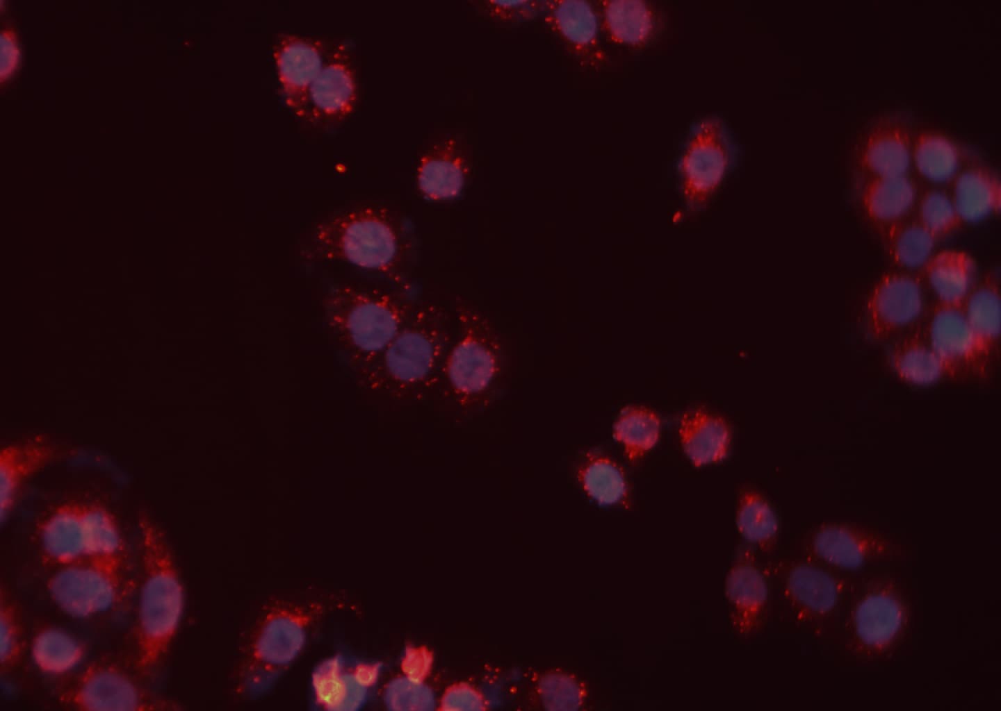 Polyclonal Rabbit anti-Human RAD52 Antibody (IHC, IF, WB)