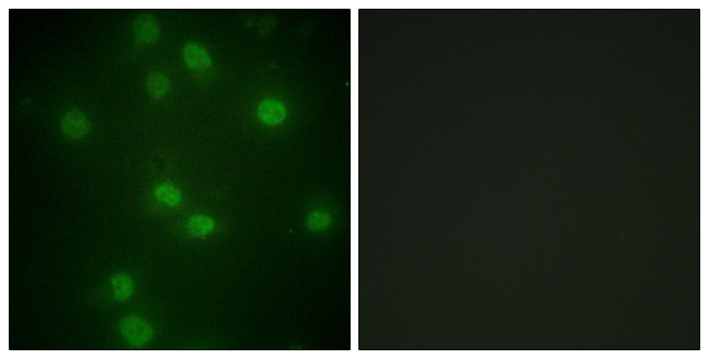 RB1 / Retinoblastoma / RB Antibody (phospho-Ser811)