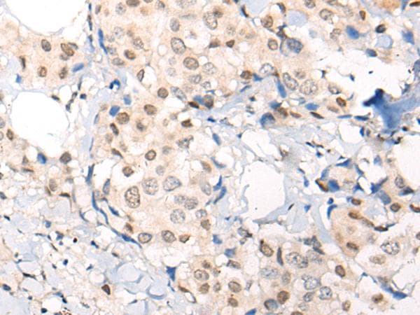 Polyclonal Rabbit anti-Human C11orf2 / Fat-Free Antibody (IHC)