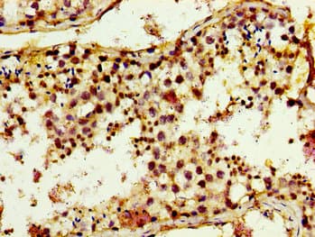 Polyclonal Rabbit anti-Human TRIM3 Antibody (IHC)