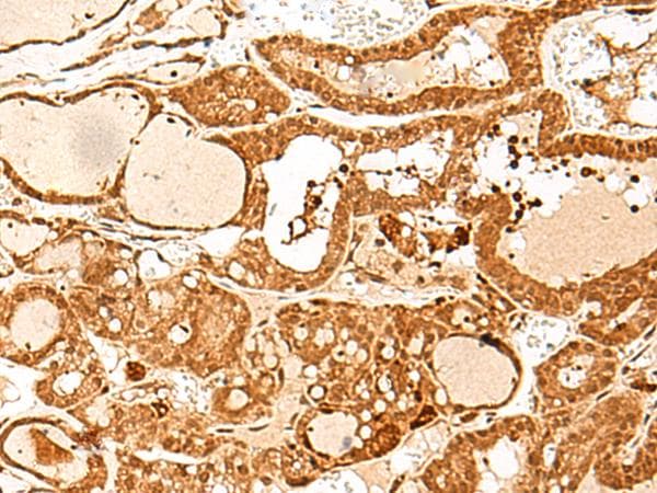 Polyclonal Rabbit anti-Human GTF3C3 Antibody (IHC)