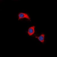 Polyclonal Rabbit anti-Human ZAP70 Antibody (Internal, IHC, IF, WB)