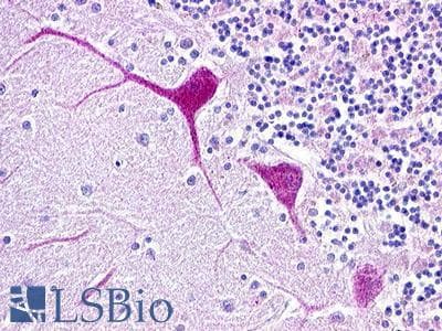 IHC-plus™ Polyclonal Rabbit anti-Human C3AR / C3a Receptor Antibody (C-Terminus, IHC)