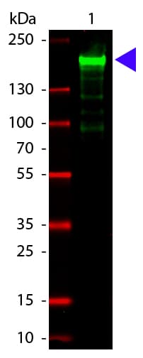 A2M / Alpha-2-Macroglobulin Antibody (Lyophilized)
