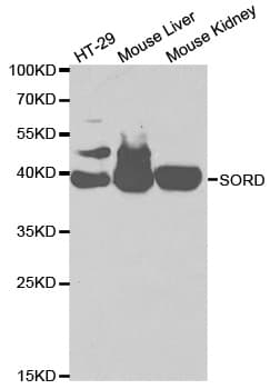 SORD / Sorbitol Dehydrogenase Antibody