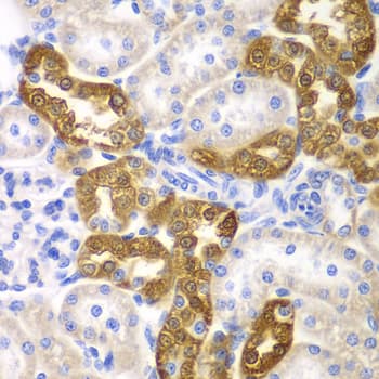 Polyclonal Rabbit anti-Human CD151 Antibody (IHC, WB)