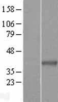 THOC6 Protein (Over-Expression Lysate Myc-DDK (Flag))