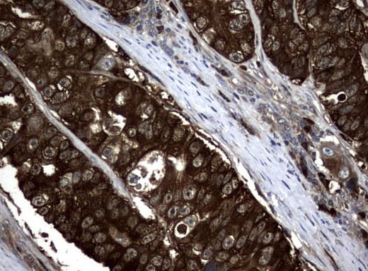 NME1 / NM23 Antibody (clone UMAB91)