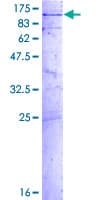 Human GLE1 Protein (Recombinant GST)